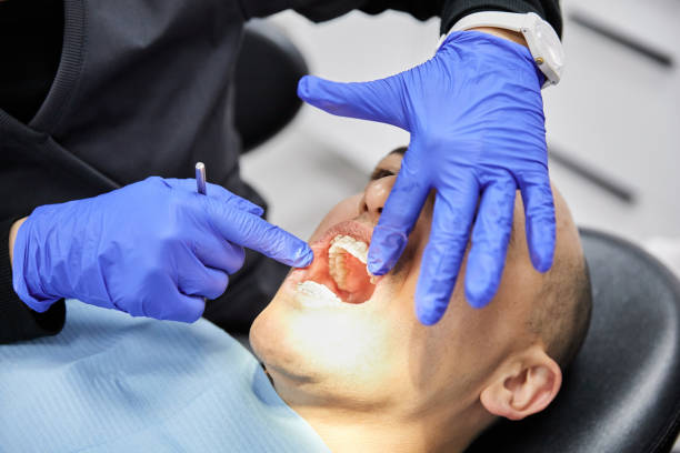 Best Urgent Care for Lost Fillings or Crowns in Radisson, NY